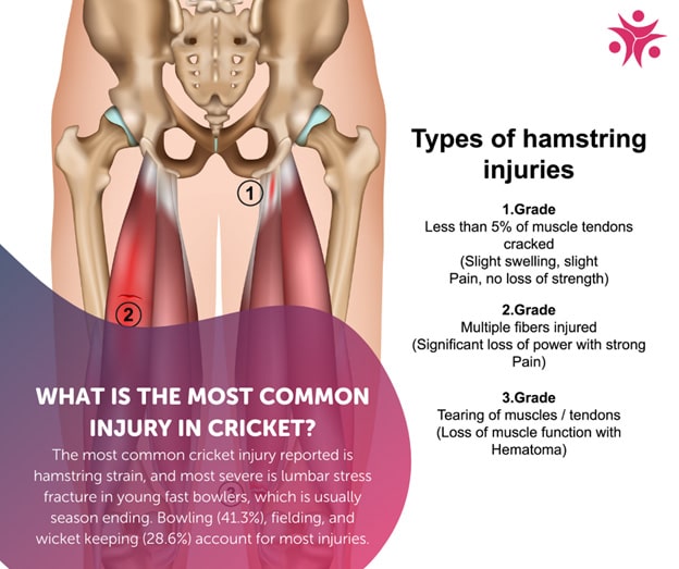 How to Manage Common Cricket Injuries